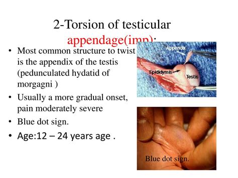 testicular torsion and swelling